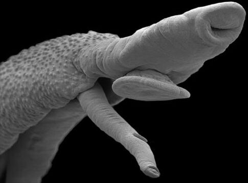 parasitic body